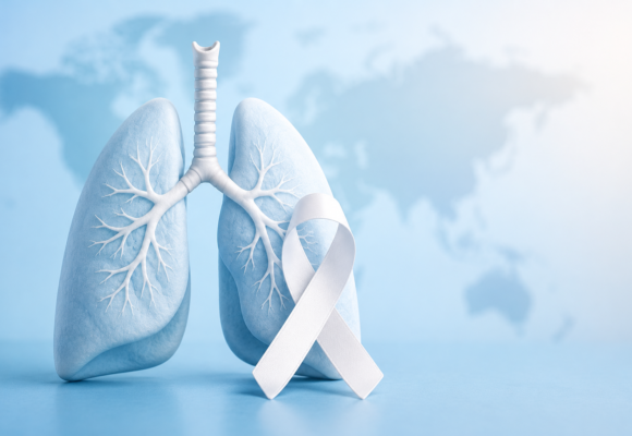 World Lung Cancer Day: Raising Awareness for Prevention, Early Detection, and Hope